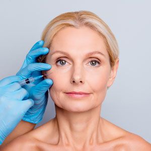 העלמת קמטי הבעה