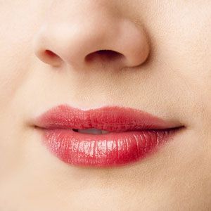 תיקון צורת השפתיים